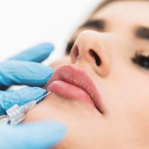 lip fillers near me