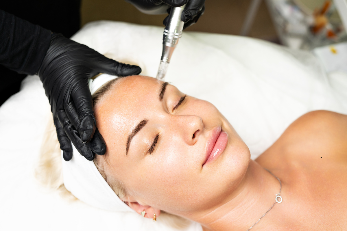 Benefits of Microneedling