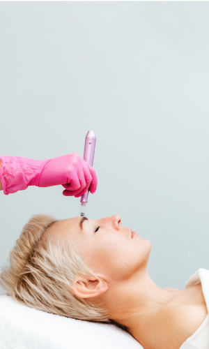 benefits of microneedling
