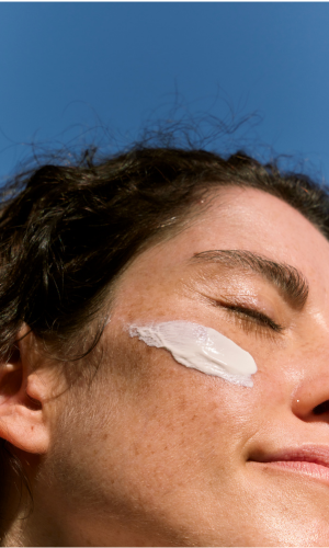 Chemical Peels and Botox