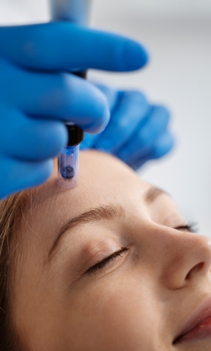 microneedling after care