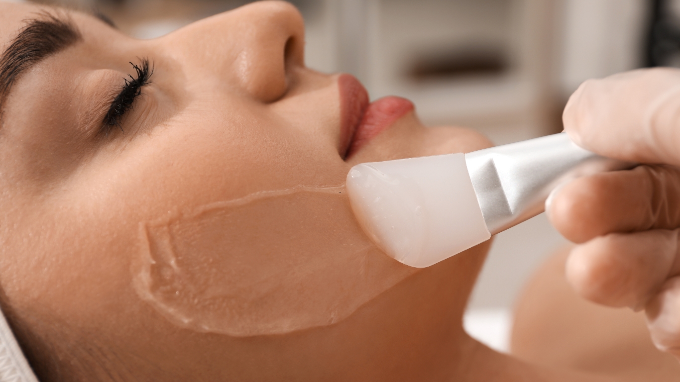 chemical peels Lakewood denver